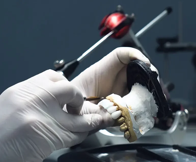 Porcelain Crowns from Lab