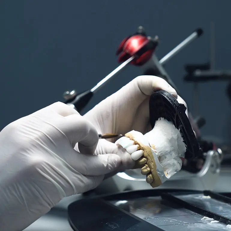 Porcelain Crowns from Lab