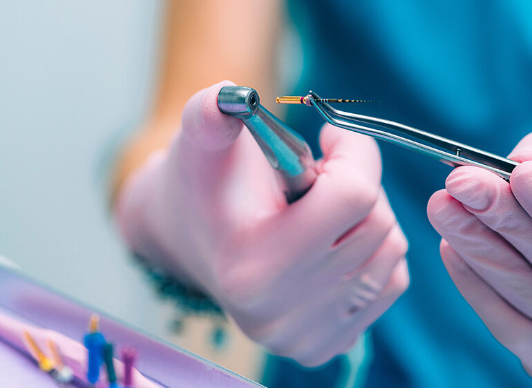 Root Canal Treatment in Turkey